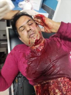 CONASADH condemns brutal attack on Sahrawi activist by Moroccan occupying forces